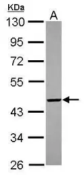 Anti-PIGO antibody [N2N3] used in Western Blot (WB). GTX118512