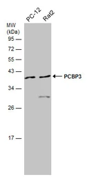 Anti-PCBP3 antibody [N1C2] used in Western Blot (WB). GTX118656