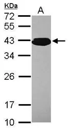 Anti-PCBP3 antibody [N1C2] used in Western Blot (WB). GTX118656