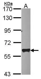 Anti-mtPAP antibody [N1C3] used in Western Blot (WB). GTX118738