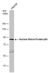 Anti-Nuclear Matrix Protein p84 antibody used in Western Blot (WB). GTX118740