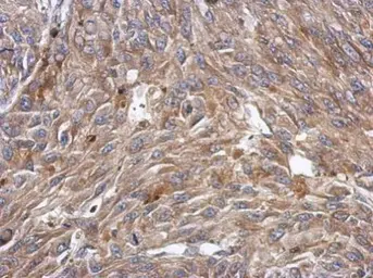 Anti-KCTD4 antibody used in IHC (Paraffin sections) (IHC-P). GTX118894