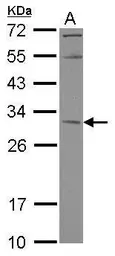 Anti-KCTD4 antibody used in Western Blot (WB). GTX118894