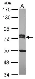 Anti-RC74 antibody [N1N2], N-term used in Western Blot (WB). GTX118946