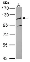 Anti-UBE3C antibody [N1N3] used in Western Blot (WB). GTX119102