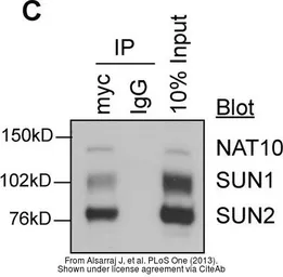 Anti-NAT10 antibody [N1N2], N-term used in Western Blot (WB). GTX119166