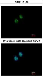 Anti-NAT10 antibody [N1N2], N-term used in Immunocytochemistry/ Immunofluorescence (ICC/IF). GTX119166