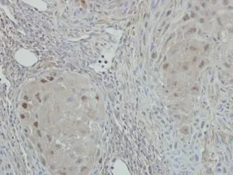 Anti-NAT10 antibody [N1N2], N-term used in IHC (Paraffin sections) (IHC-P). GTX119166