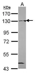 Anti-NAT10 antibody [N1N2], N-term used in Western Blot (WB). GTX119166