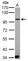 Anti-PCDHGA6 antibody [N1N3] used in Western Blot (WB). GTX119183