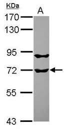 Anti-RUFY1 antibody [N3C3] used in Western Blot (WB). GTX119223