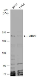 Anti-UBE2O antibody [C1C2], Internal used in Western Blot (WB). GTX119315