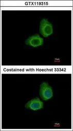 Anti-UBE2O antibody [C1C2], Internal used in Immunocytochemistry/ Immunofluorescence (ICC/IF). GTX119315