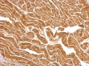 Anti-UBE2O antibody [C1C2], Internal used in IHC (Paraffin sections) (IHC-P). GTX119315