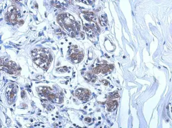 Anti-UBE2O antibody [C1C2], Internal used in IHC (Paraffin sections) (IHC-P). GTX119315