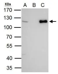 Anti-CHD1L antibody [N2C1], Internal used in Immunoprecipitation (IP). GTX119360