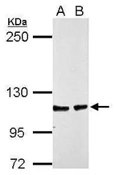 Anti-CHD1L antibody [N2C1], Internal used in Western Blot (WB). GTX119360