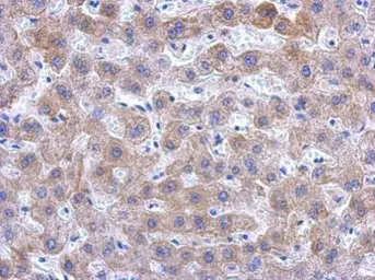 Anti-KIR2DS2 antibody used in IHC (Paraffin sections) (IHC-P). GTX119433