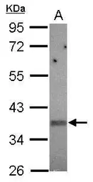 Anti-KIR2DS2 antibody used in Western Blot (WB). GTX119433