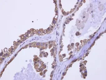 Anti-DDX43 antibody used in IHC (Paraffin sections) (IHC-P). GTX119498