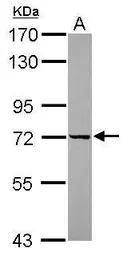Anti-DDX43 antibody used in Western Blot (WB). GTX119498
