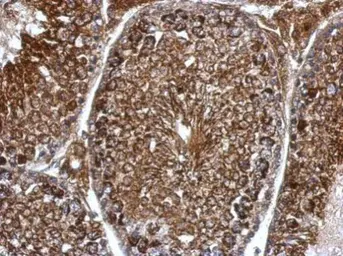 Anti-Pyruvate Dehydrogenase E1 beta subunit antibody used in IHC (Paraffin sections) (IHC-P). GTX119625