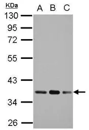 Anti-Pyruvate Dehydrogenase E1 beta subunit antibody used in Western Blot (WB). GTX119625