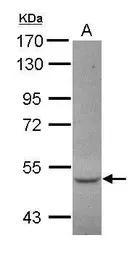 Anti-CCDC17 antibody [C1C3] used in Western Blot (WB). GTX120083