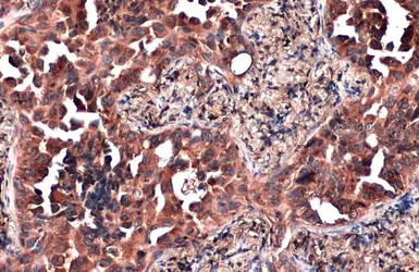 Anti-ZC3HAV1 antibody [N3C2], Internal used in IHC (Paraffin sections) (IHC-P). GTX120134