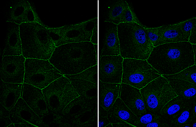 Anti-CGN antibody used in Immunocytochemistry/ Immunofluorescence (ICC/IF). GTX120159