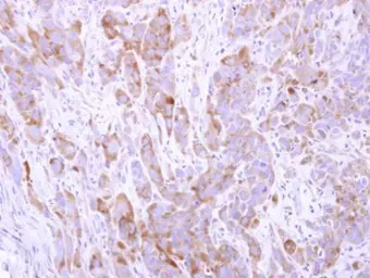 Anti-CGN antibody used in IHC (Paraffin sections) (IHC-P). GTX120159