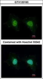 Anti-UNKL antibody [N1N2], N-term used in Immunocytochemistry/ Immunofluorescence (ICC/IF). GTX120163