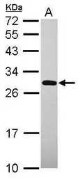 Anti-UNKL antibody [N1N2], N-term used in Western Blot (WB). GTX120163