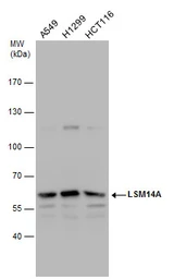 Anti-LSM14A antibody used in Western Blot (WB). GTX120187