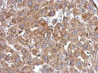 Anti-KCTD3 antibody [C2C3], C-term used in IHC (Paraffin sections) (IHC-P). GTX120229