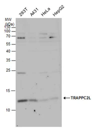 Anti-TRAPPC2L antibody used in Western Blot (WB). GTX120259