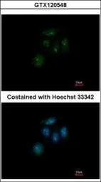 Anti-ZNF642 antibody [N1C1] used in Immunocytochemistry/ Immunofluorescence (ICC/IF). GTX120548