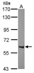 Anti-ZNF642 antibody [N1C1] used in Western Blot (WB). GTX120548