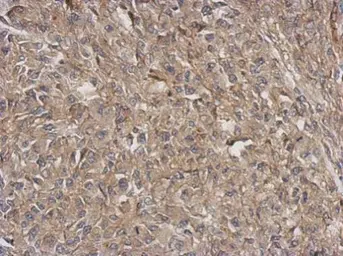 Anti-ARPC5L antibody [N1C3] used in IHC (Paraffin sections) (IHC-P). GTX120725