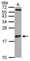 Anti-ARPC5L antibody [N1C3] used in Western Blot (WB). GTX120725