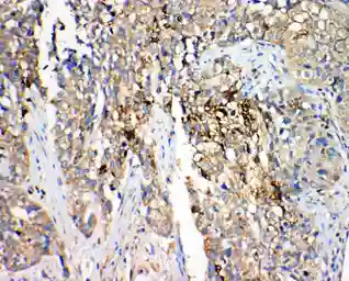 Anti-HSD17B4 antibody used in IHC (Paraffin sections) (IHC-P). GTX12084