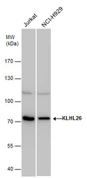 Anti-KLHL26 antibody used in Western Blot (WB). GTX120879