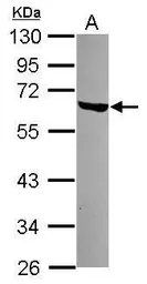 Anti-LSM14A antibody [N3C3] used in Western Blot (WB). GTX120902