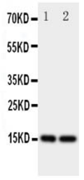 Anti-FABP5 antibody used in Western Blot (WB). GTX12109