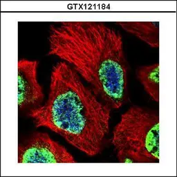 Anti-Histone H3K27me3 (Tri-methyl Lys27) antibody used in Immunocytochemistry/ Immunofluorescence (ICC/IF). GTX121184