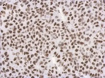 Anti-Histone H3K27me3 (Tri-methyl Lys27) antibody used in IHC (Paraffin sections) (IHC-P). GTX121184