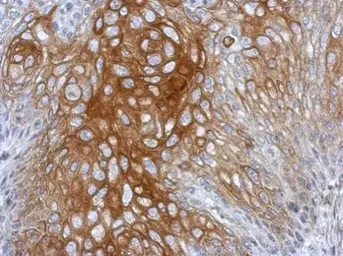 Anti-BRD9 antibody used in IHC (Paraffin sections) (IHC-P). GTX121386