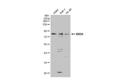 Anti-BRD9 antibody used in Western Blot (WB). GTX121386