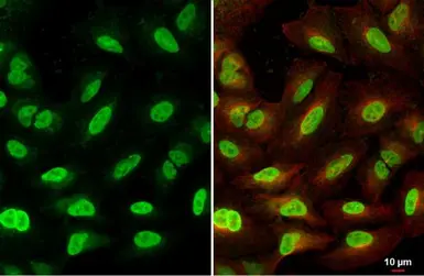 Anti-BRD9 antibody used in Immunocytochemistry/ Immunofluorescence (ICC/IF). GTX121386