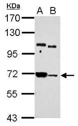 Anti-Sts1 antibody used in Western Blot (WB). GTX121603